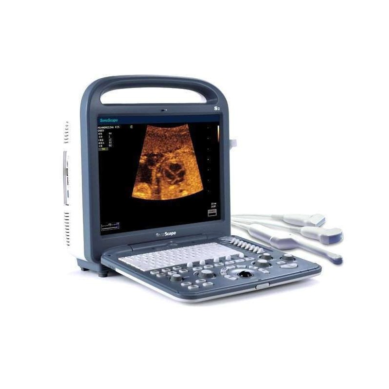 Ultrassom Veterinário Sonoscape S2 Vet -LCD 15, USB, Bateria, D