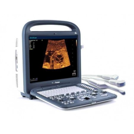 Ultrassom Veterinário Sonoscape S2 Vet -LCD 15, USB, Bateria, D