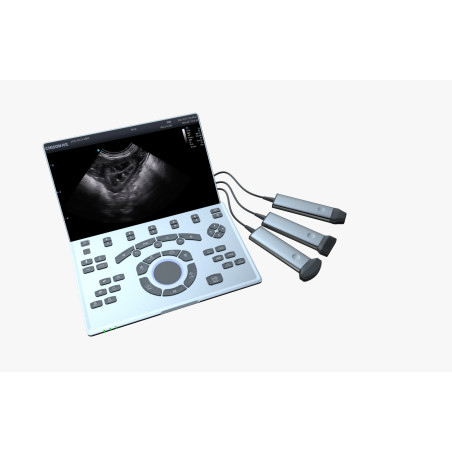 Ultrassom Veterinário Chison SonoAir  Vet – Portátil de Alta Performance | Evolução Pet